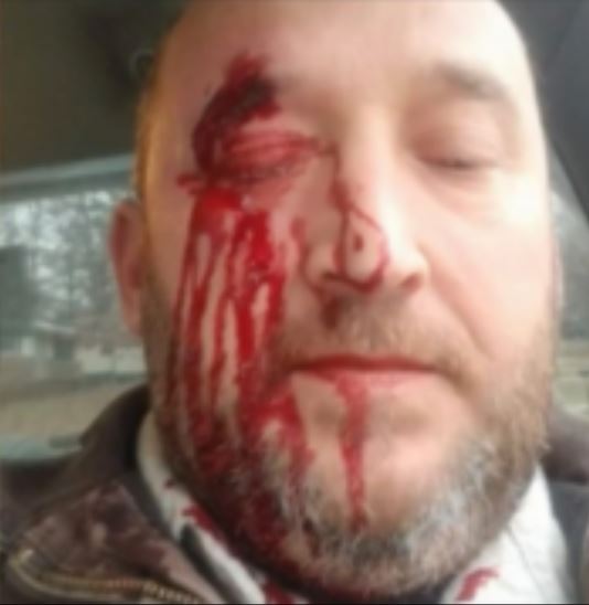 Beaten Repo Man Upset with Police